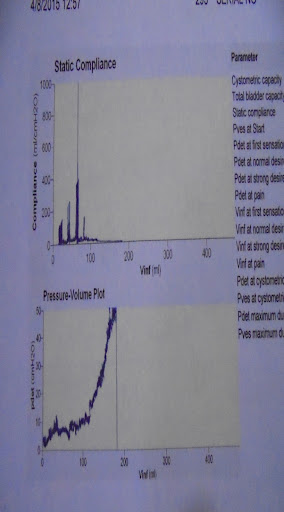 Cystométrie pré