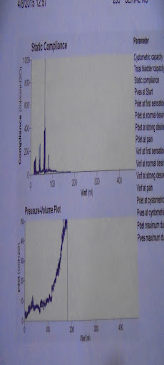 Étude urodynamique